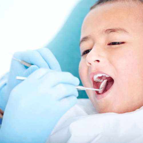 caries dientes de leche